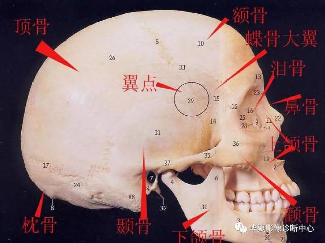 最全的颅骨ct解剖及外伤骨折的诊断