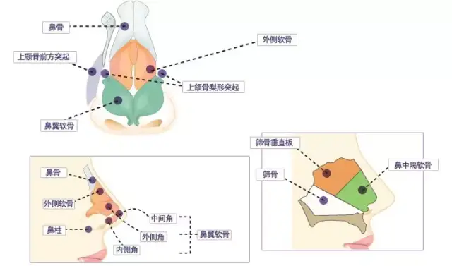 你的鼻子为什么不好看?