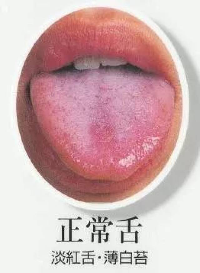 如果你和我一样是这种粉嫩健康的舌头,也不要太高兴,要保持健康的