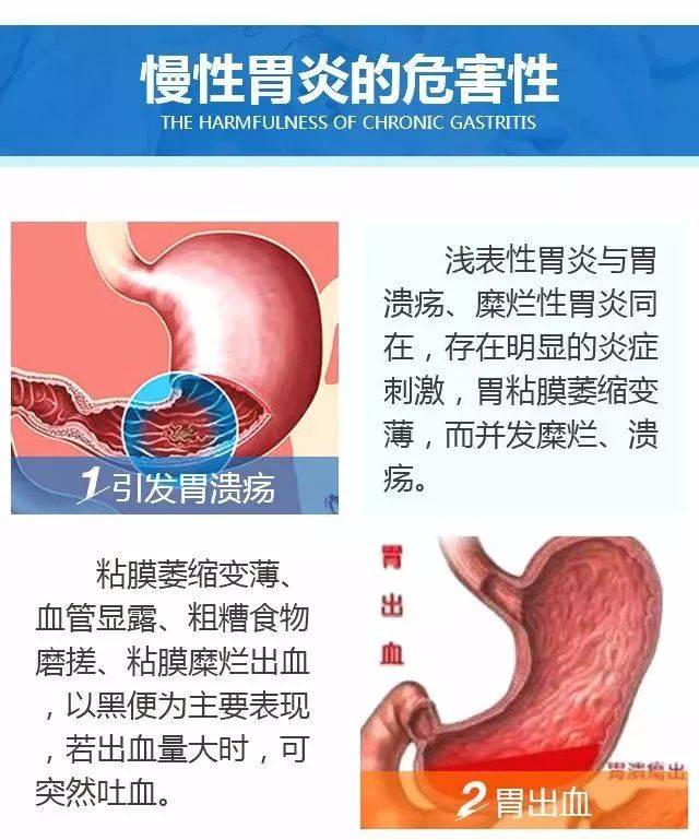 目前,cbi技术已被临床广泛应用于barrett食管诊断,早期胃癌发现,肠道