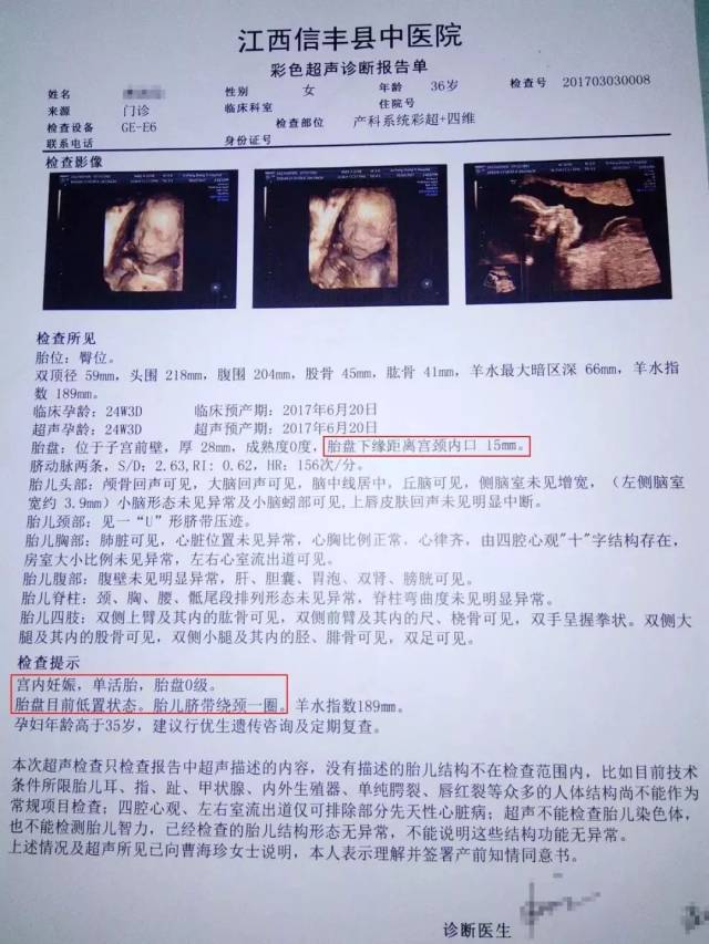 从b超单上看,这位孕妈胎盘还属于低置状态,其实并不算前置胎盘.