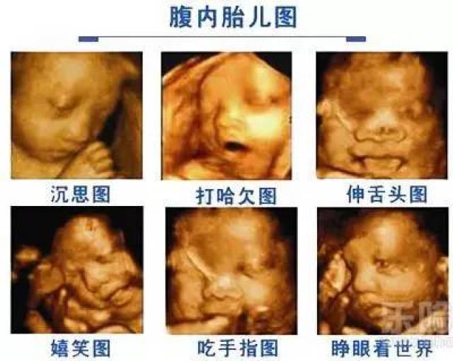 由于胎儿存在特殊血流动力学的原因: 有些畸形如房间隔缺损,室间隔