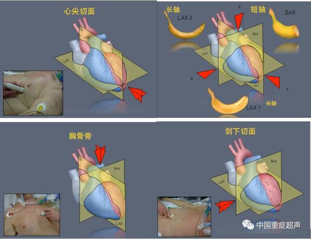 长轴平面,短轴平面与四腔平面为经胸心脏超声的三个最基本平面,从这