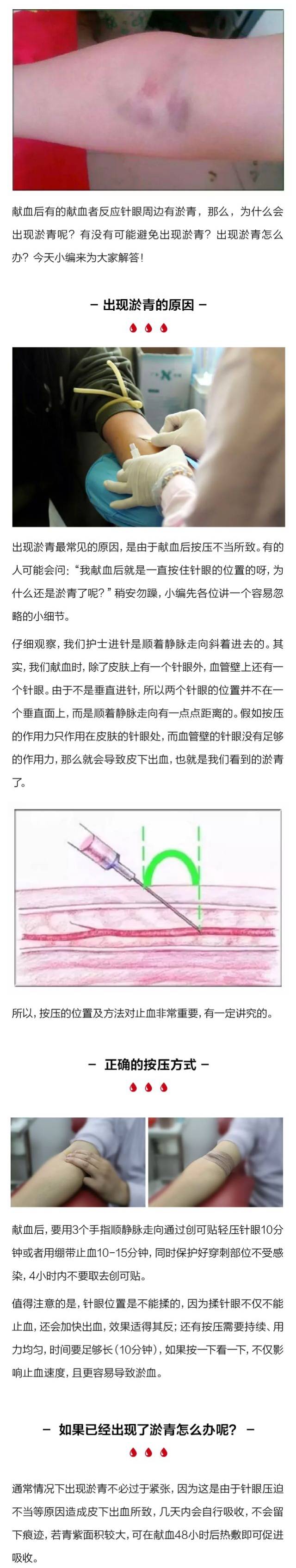 献血后针眼周边淤青