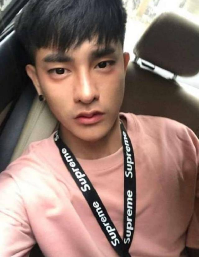 长太丑受不了社会歧视,他整了30次容变大帅哥,还穿起了女装