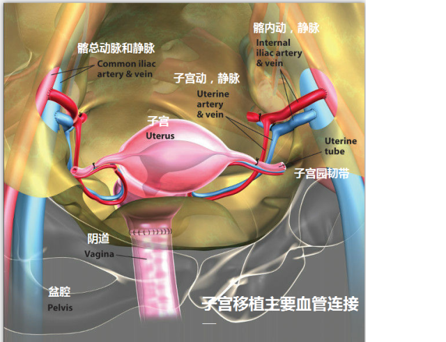 子宫移植,用生育自己的子宫孕育自己的孩子