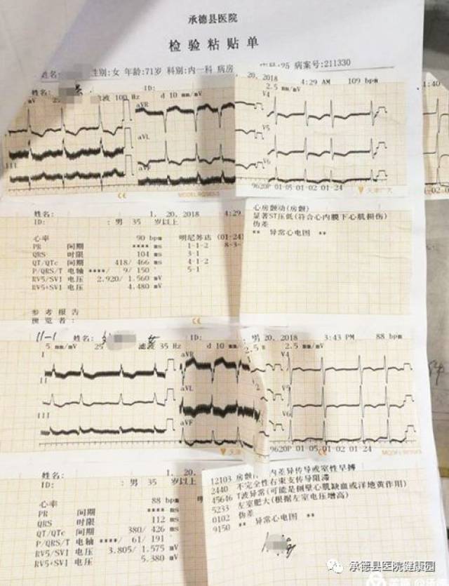 承德县医院内一科成功为三支血管病变患者解除心脏疼痛