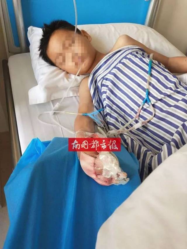 心疼!定安3小孩儿玩鞭炮被炸伤 视频疯传 爆炸就在一瞬间