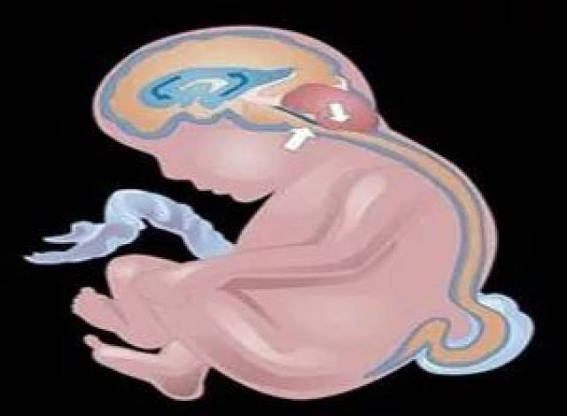 孕期常见的七种胎儿畸形分析