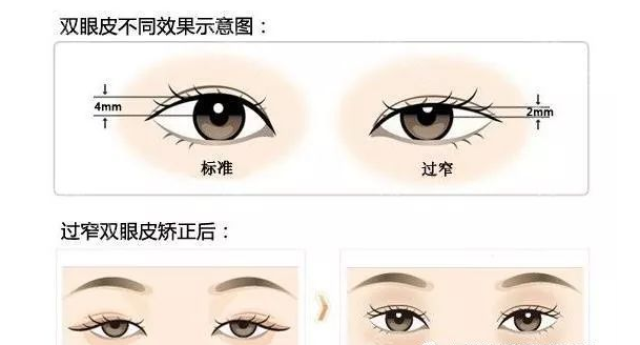 啥是无痕修复 54884ec67acd4f15afde0fa8f1ae5f37.jpg