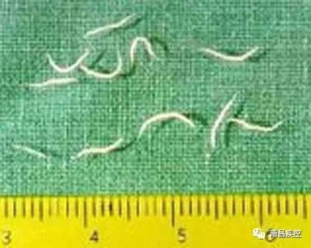 蛲虫是蠕形住肠线虫的简称,外形似一条白线,成虫主要寄生于人体的