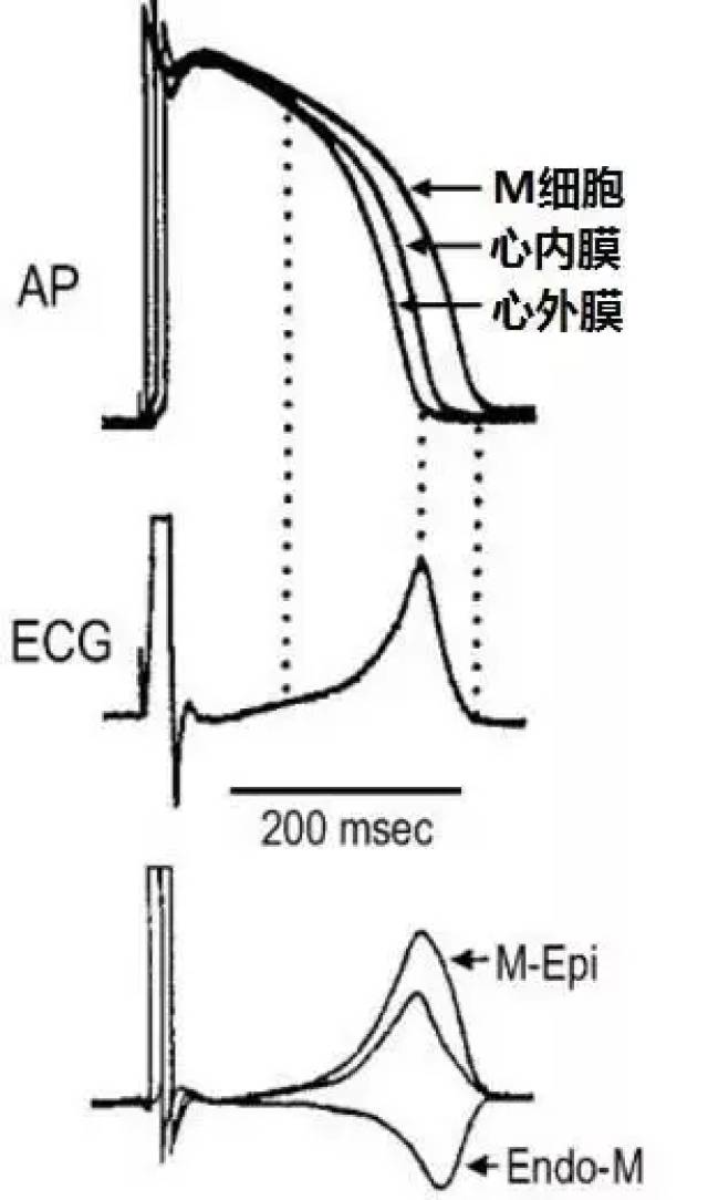 图4 跨室壁复极离散度: 三层心室肌细胞动作电位时程的差异.