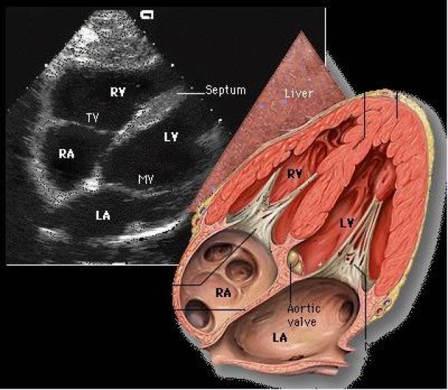 二维心超常用切面及容易忽视的细节
