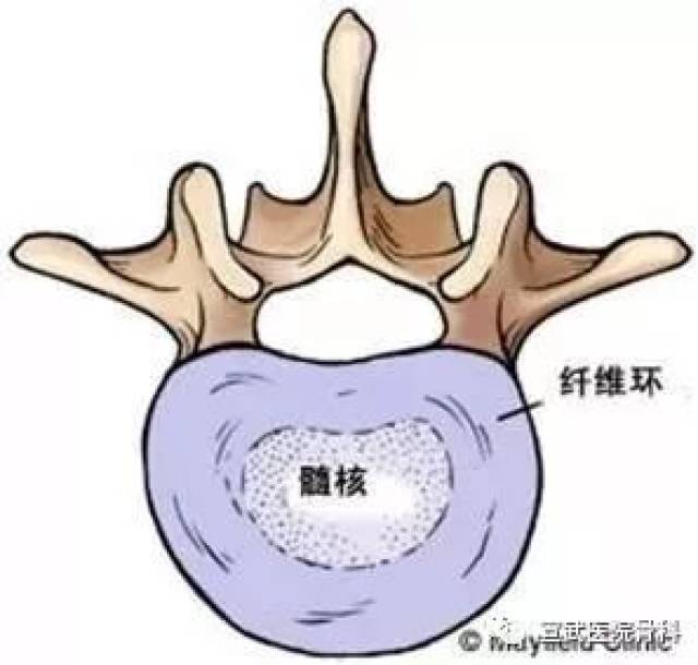 椎间盘由髓核和纤维环组成