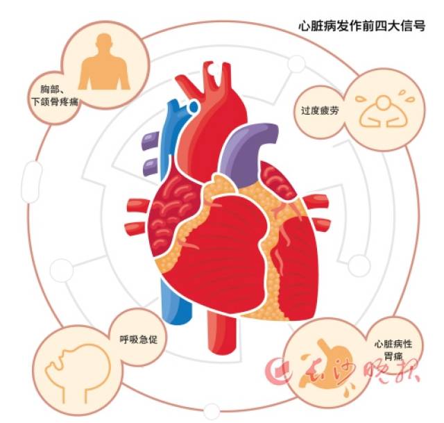 出现哪些症状,就要进一步检查明确是否得了冠心病?_手机搜狐网