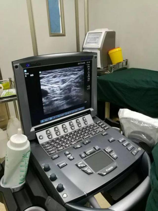 如何从零开始学习超声引导下神经阻滞?这篇文章你不可
