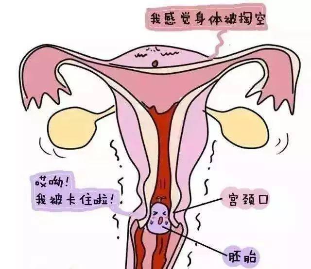 人流是什么原理是什么意思_胖次是什么意思图(3)