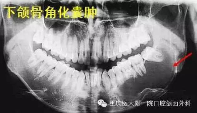 口腔颌面部常见肿瘤图谱