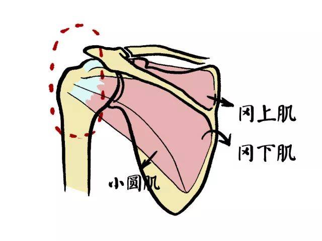 肩袖到底是啥样子呢—顾名思义,类似衣袖一样包裹肱骨头的四根肌腱