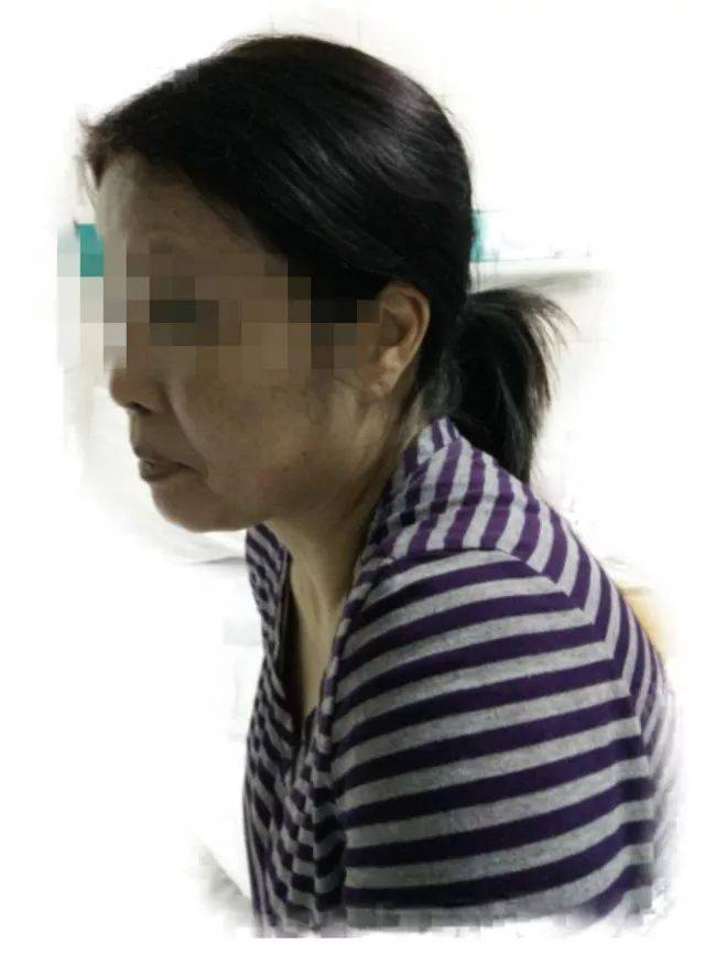 患病后,龙女士脸色灰暗 标题