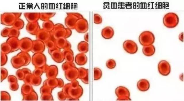 红细胞破坏过多