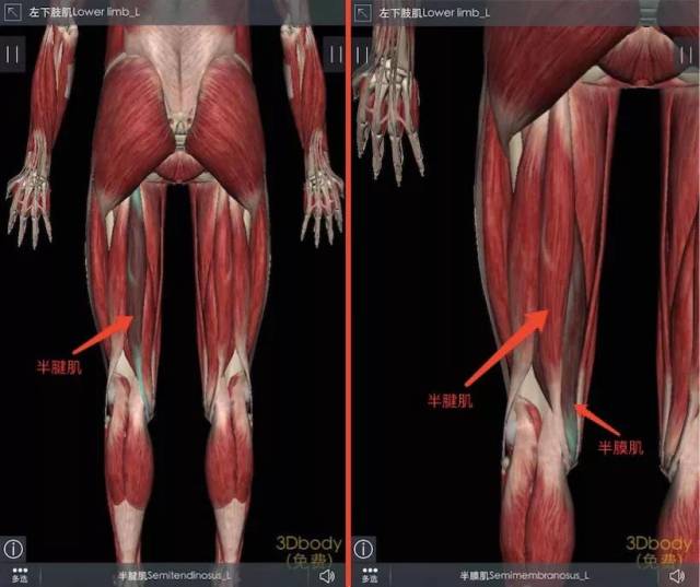 月11日同样部位的扫描图 恢复情况总结 经过9次恢复课程,肌肉粘连消除