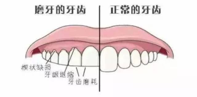 德国牙总人口_德国牧羊犬(2)