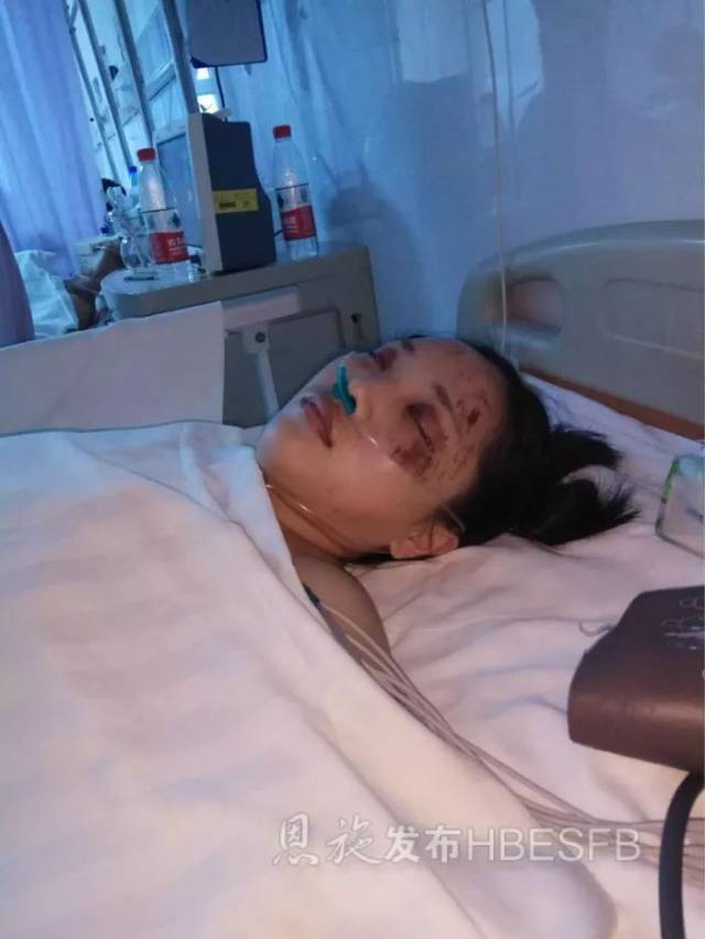 一场无情的车祸,让她从一个 青春靓丽的花季女孩,变成了 一位截瘫