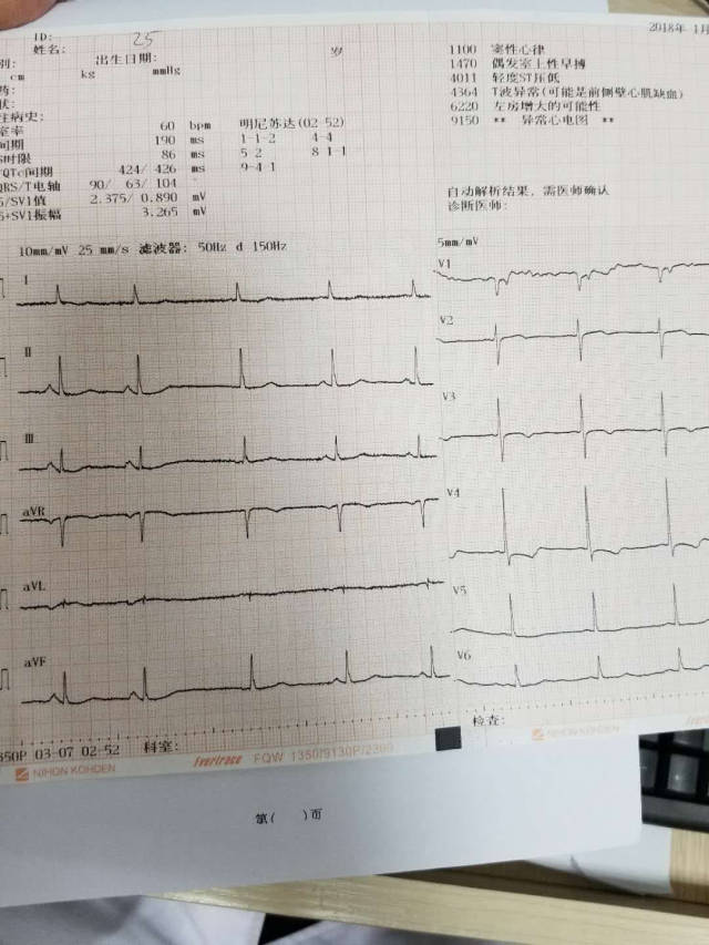 比较明显的前壁心肌缺血,使用中医经方治验录!