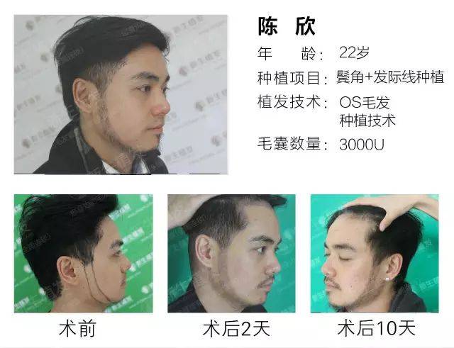 鬓角"胡"上线,你也想拥有胡歌同款吗?