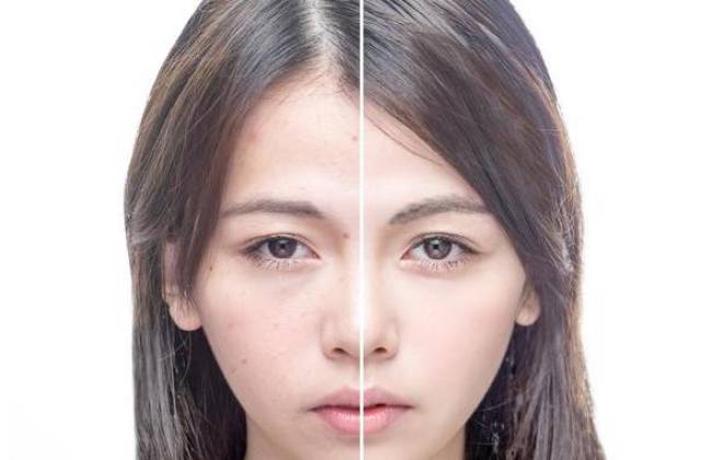 毛孔不粗、痘痘不长,你把体内的垃圾毒素排完