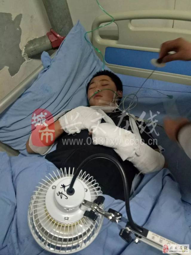 造孽:宜宾14岁孩子双手被火炮炸伤,右手拇指被切除