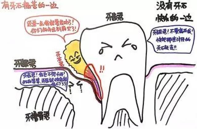 有钱没钱,洗牙过年.