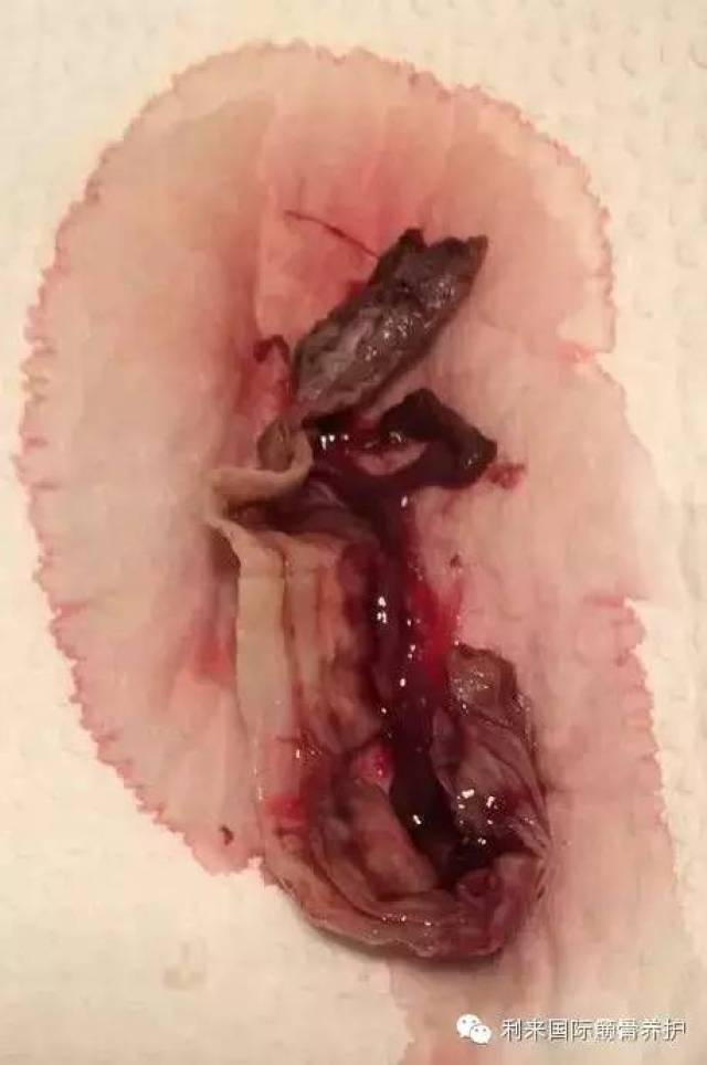 2, 排出许多白皮或只排白皮?