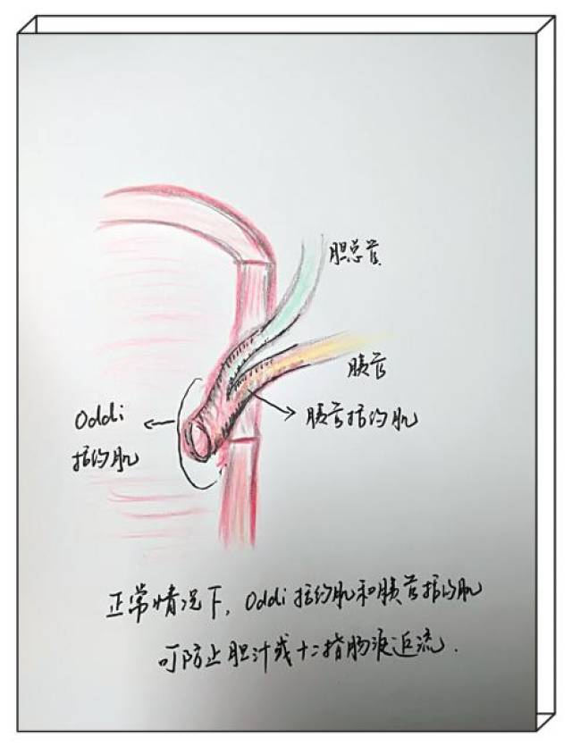 过节不得不防:急性胰腺炎 —黄镇医生手绘图文科普系列(8)