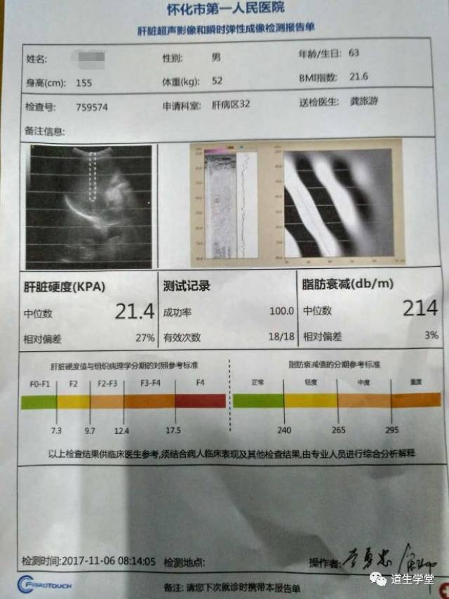 6kpa 但是这已经说明患者肝硬化指标出现显著的变化,坚持努力一定会