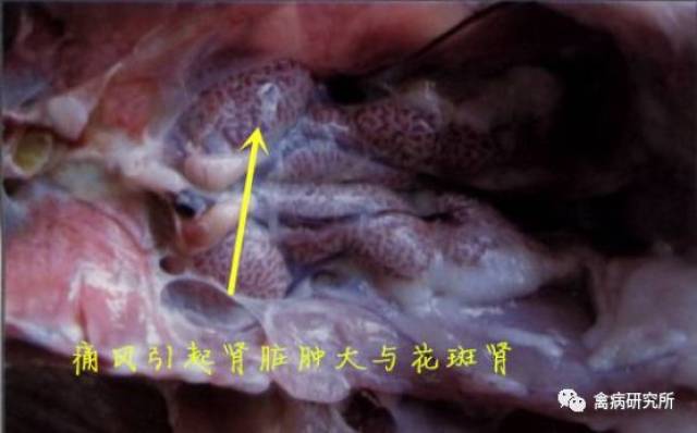 2,花斑肾,输尿管结石 3,严重者,内脏表面有尿酸盐沉积.