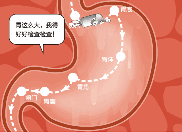 我制定了一份完整而省时的路线图:贲门,胃底,胃体,胃角,胃窦,幽门
