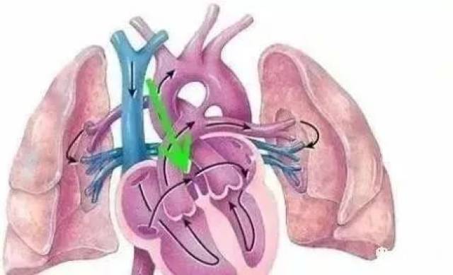 左右心房的血液是相通的,正常情况下,随着年龄的增长,当肺循环完善后