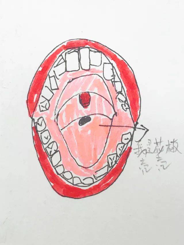qiā牙齿:一种舌头知道,但手始终不知道它在哪儿的苦恼