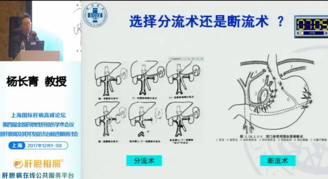 a,可在有条件的医疗中心行外科分流术/tips挽救治疗,未推荐断流术