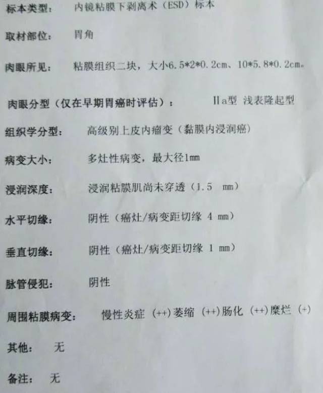 常规白光内镜活检结果不同于特殊内镜活检时,需警惕早期胃癌!