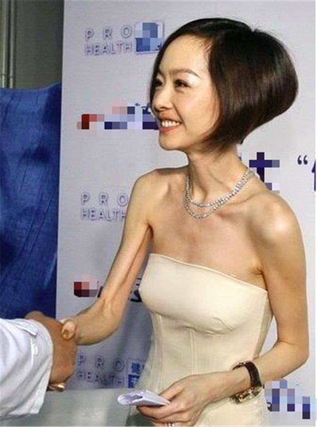 娱乐圈中瘦骨嶙峋的女星,瘦真的是美吗!