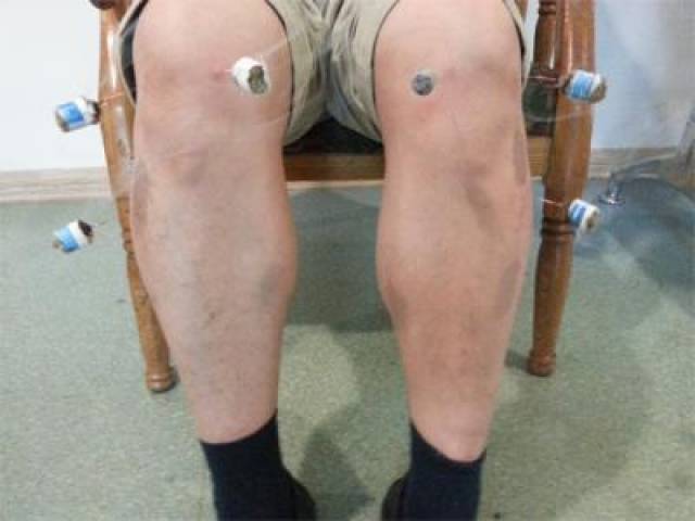 宜宾针灸推拿,按摩正骨蒋老师:膝关节骨关节炎的诊断和治疗方法