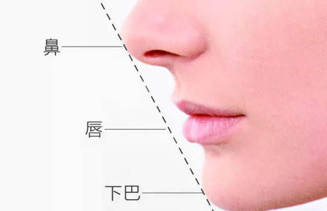 下巴突出点在同一直线上 下唇与下巴之间有较明显的美学凹陷 标准颏唇