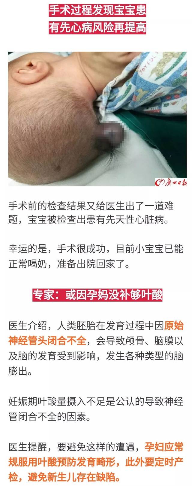 吓人!刚出生婴儿脑袋裂了 还长出"尾巴"妈妈怀孕时没注意这件事