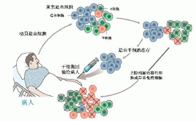 儿童白血病化疗的基本步骤和过程!