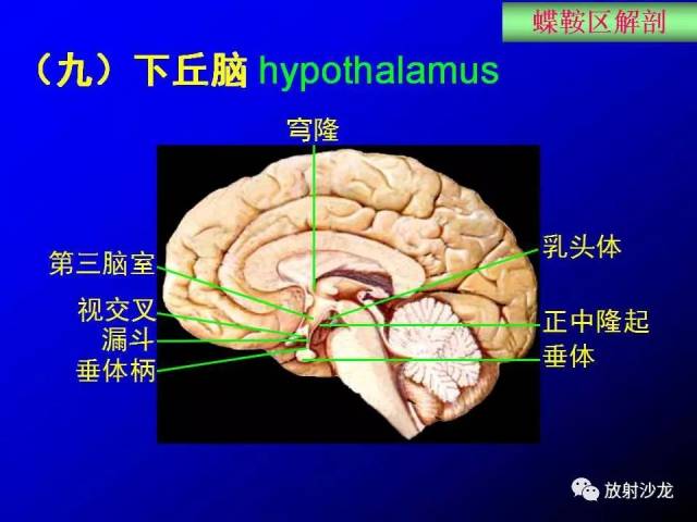 蝶鞍区解剖及疾病的影像解剖