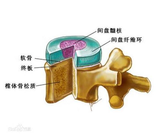 腰椎间盘突出彻底康复真的能做到吗?