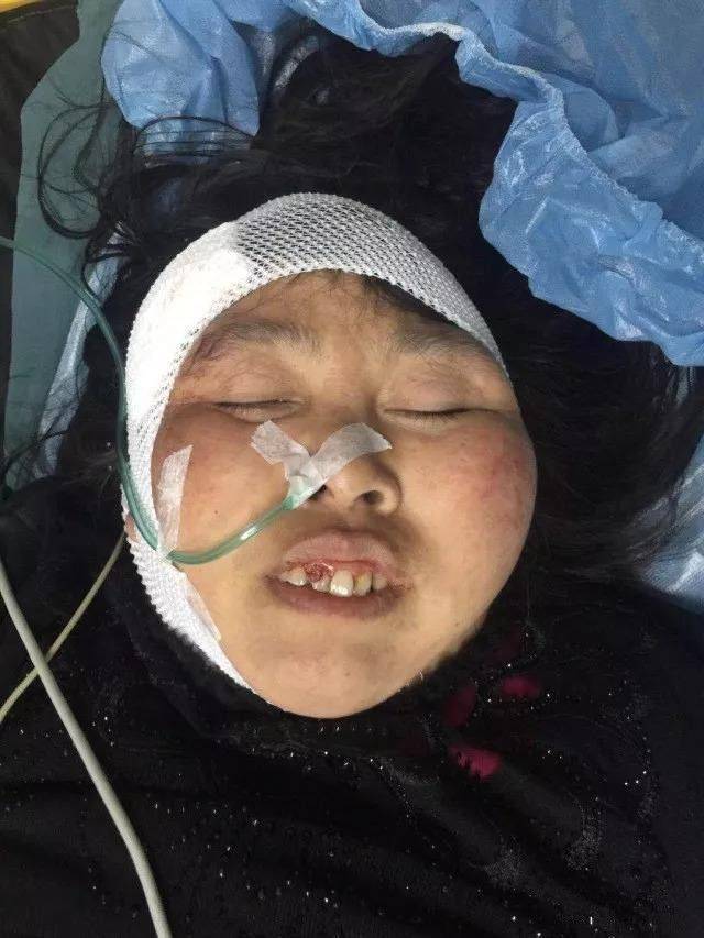 女子因车祸脑干出血陷入昏迷 急寻家人
